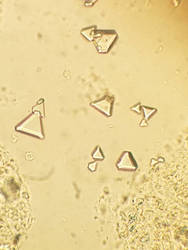 Triple phosphate crystals in urine. 