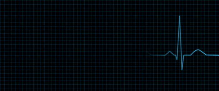 EKG/ECG simple animation