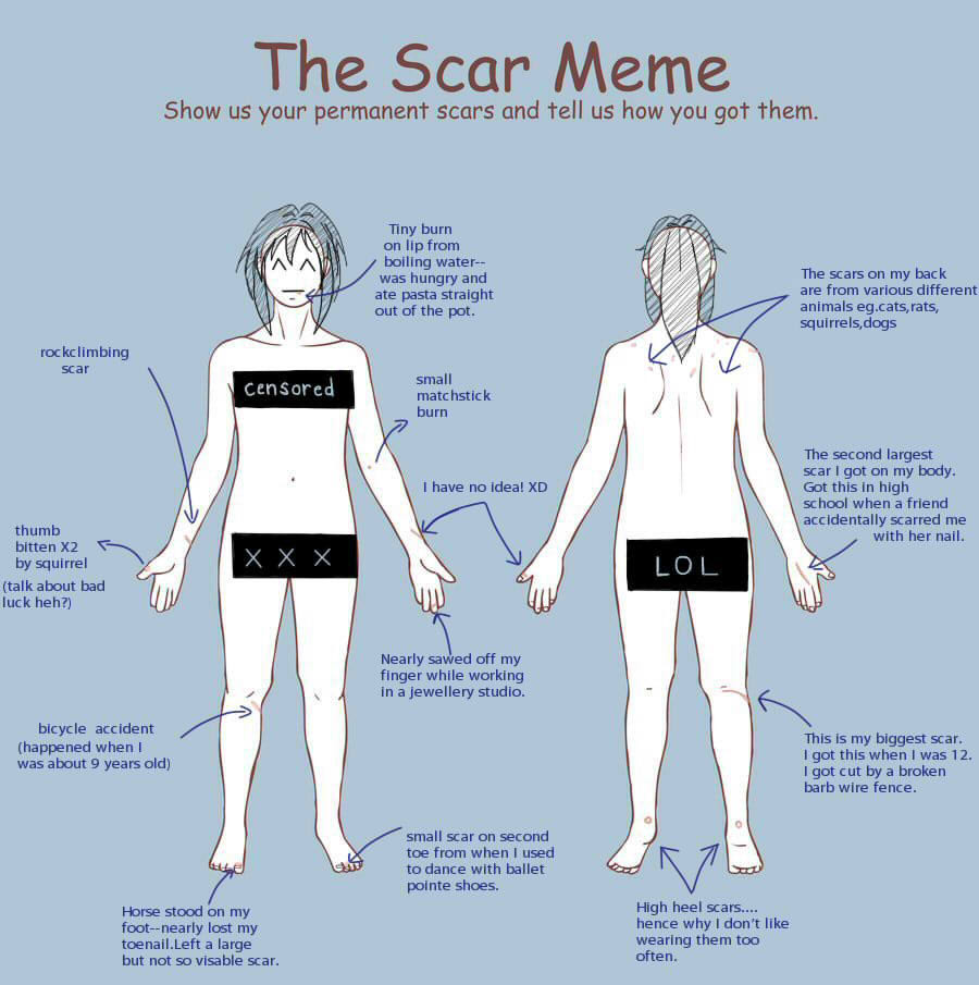 The Scar meme