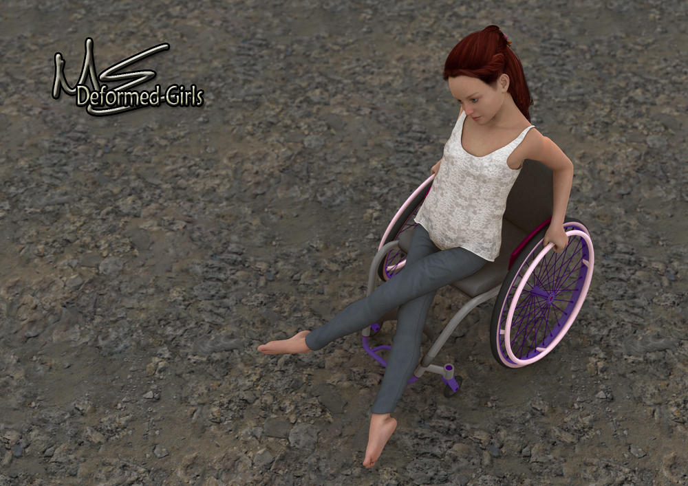 Leg Modification Deviantart Disable Legs, Deformed Feet by Onefootbare1982 on DeviantArt
