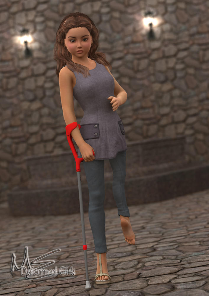 Leg Modification Deviantart Short Leg Girl by Onefootbare1982 on DeviantArt