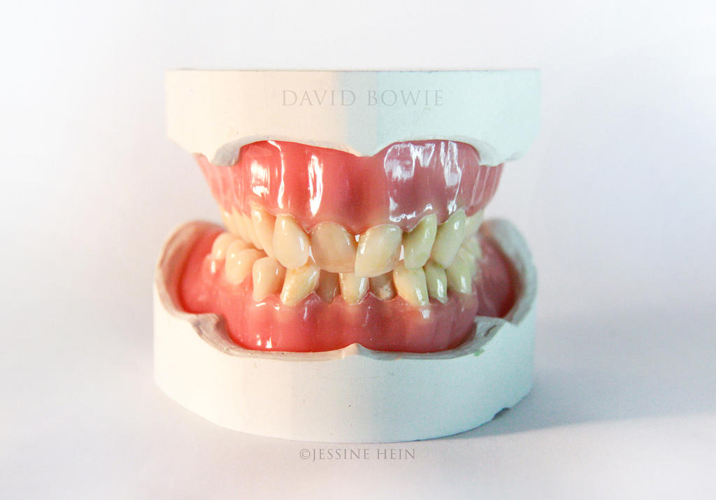 David Bowie Denture