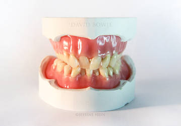 David Bowie Denture