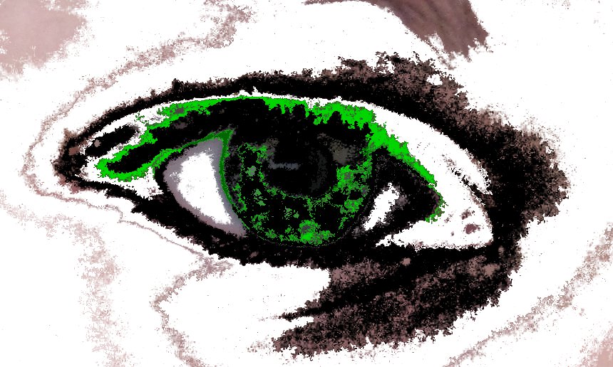 Eye