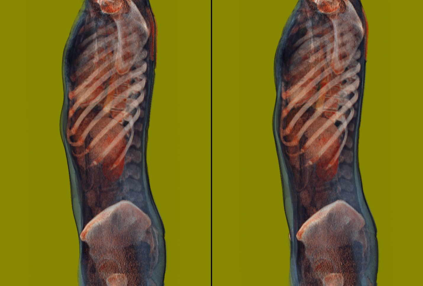 Transparent Torso 4 by voxel123 on DeviantArt