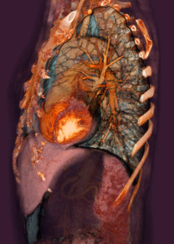 Semi-Transparent Thorax 1.2