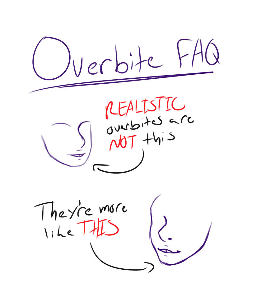 Overbite FAQ by Umbreeunix on DeviantArt