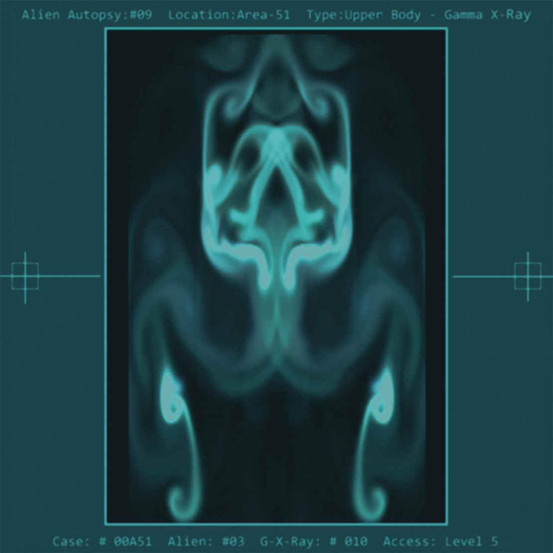 Alien Autopsy G-X-Ray