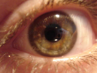 Eye