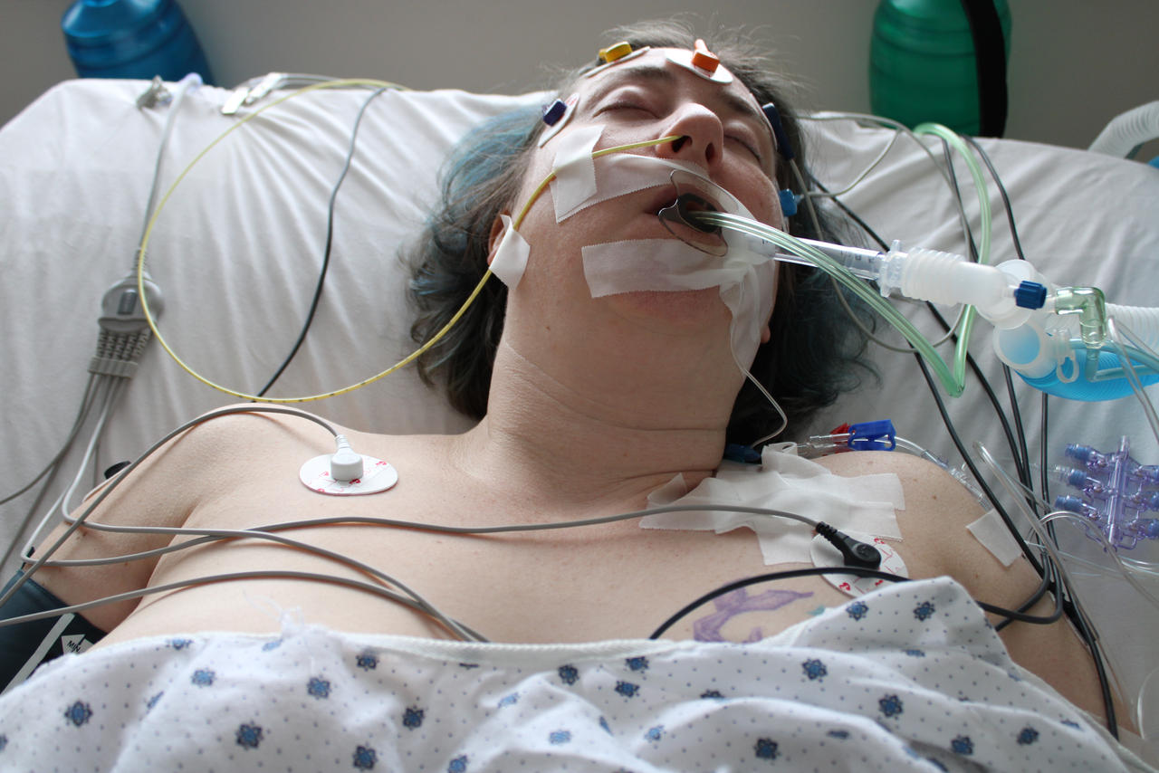 On Life Support on life support by AnesthesiaClinic on DeviantArt