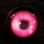 We have Pink Eye.