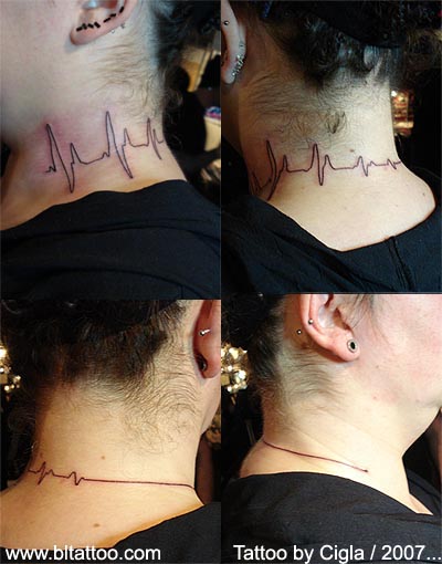 EKG line