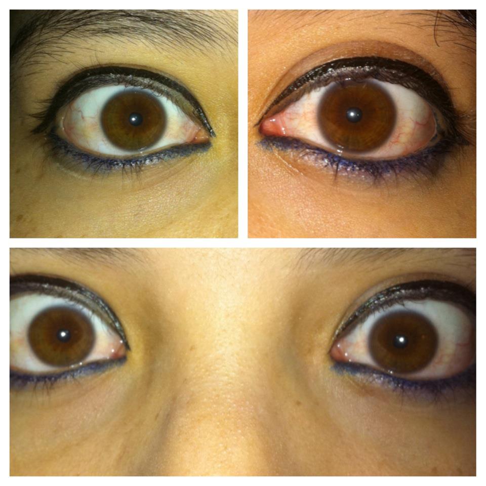 Heterochromia Eyes Different Shades Of Brown By Sapphireeagle On Deviantart