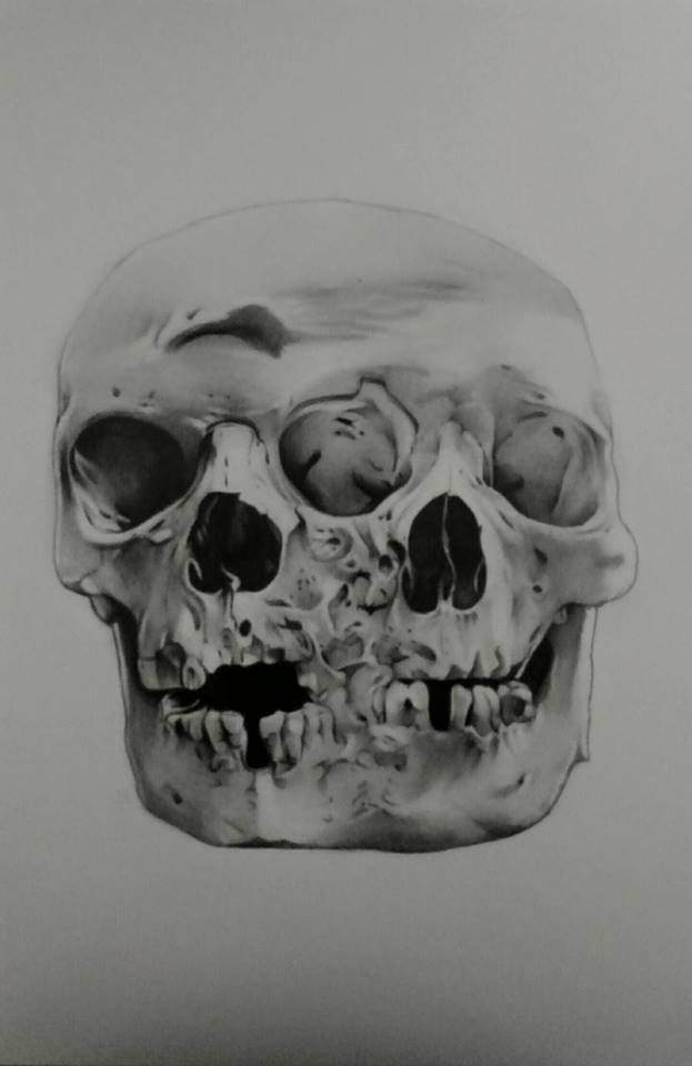 Deformed human skull