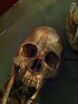 Bronze Skull