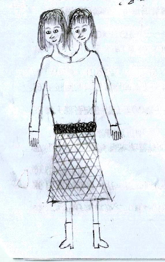 conjoined twins by jackiip on DeviantArt