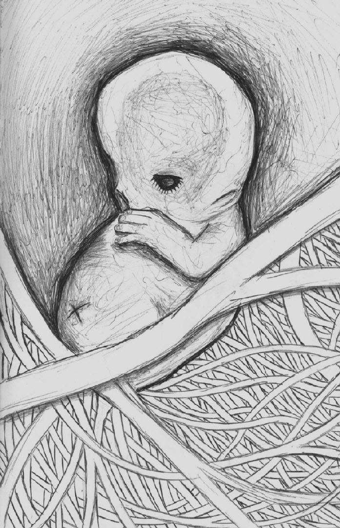 Birth Of The Devil Foetus By SSuicide On DeviantArt birth-of-the-devil-foetus-by-ssuicide-on-deviantart