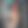 Redheaded victim of MC laser