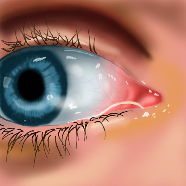 Eye wip