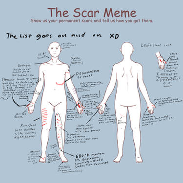 The scar meme (edit)