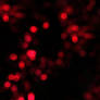 Pink Bokeh Texture