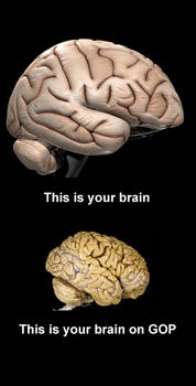 This is your brain
