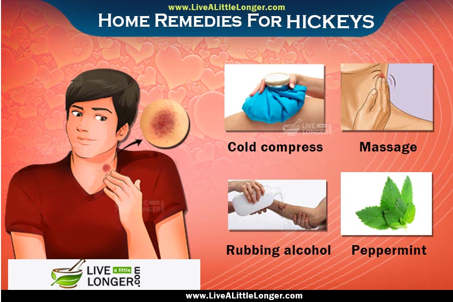How-To-Get-Rid-Of-A-Hickey By Johnmuller3Sins On Deviantart