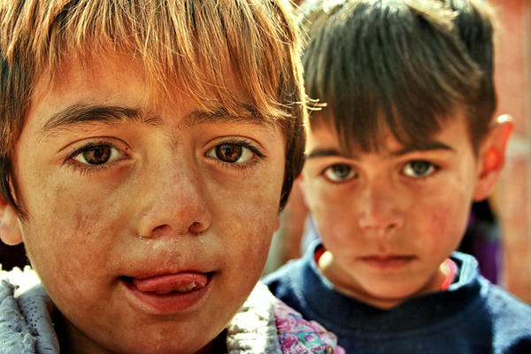 Gipsy Children From Kosovo