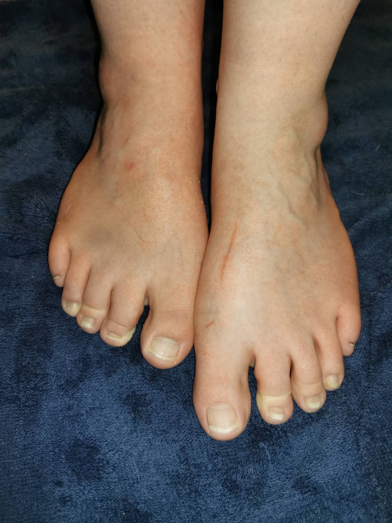 Ffet Pic Feet Pic by Lovelyfeets on DeviantArt