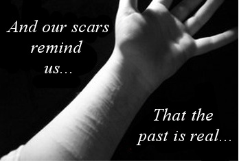 Scars by MuseofMemory