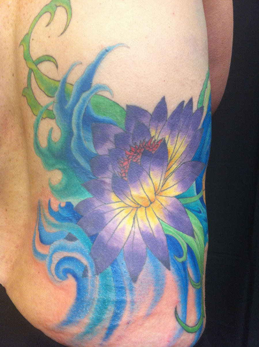 Back of kidney scar cover-up