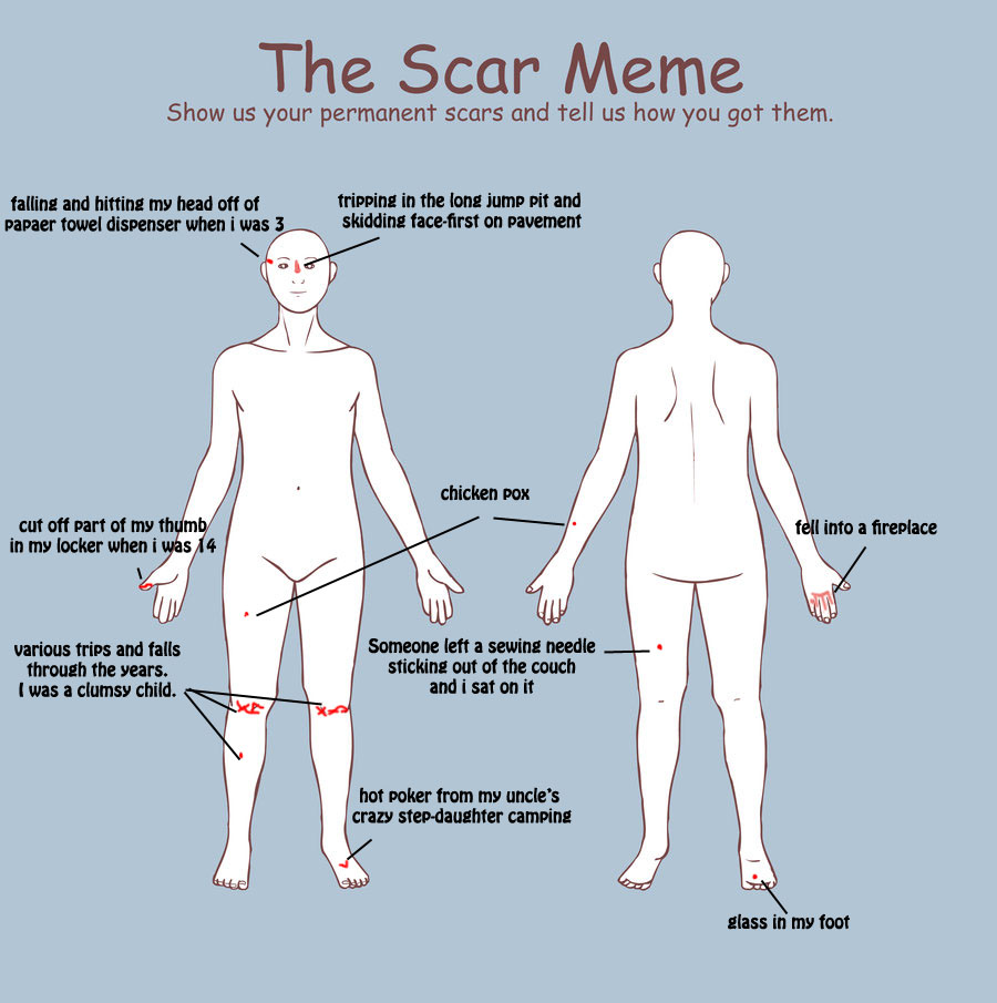 scar meme