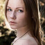 Freckles