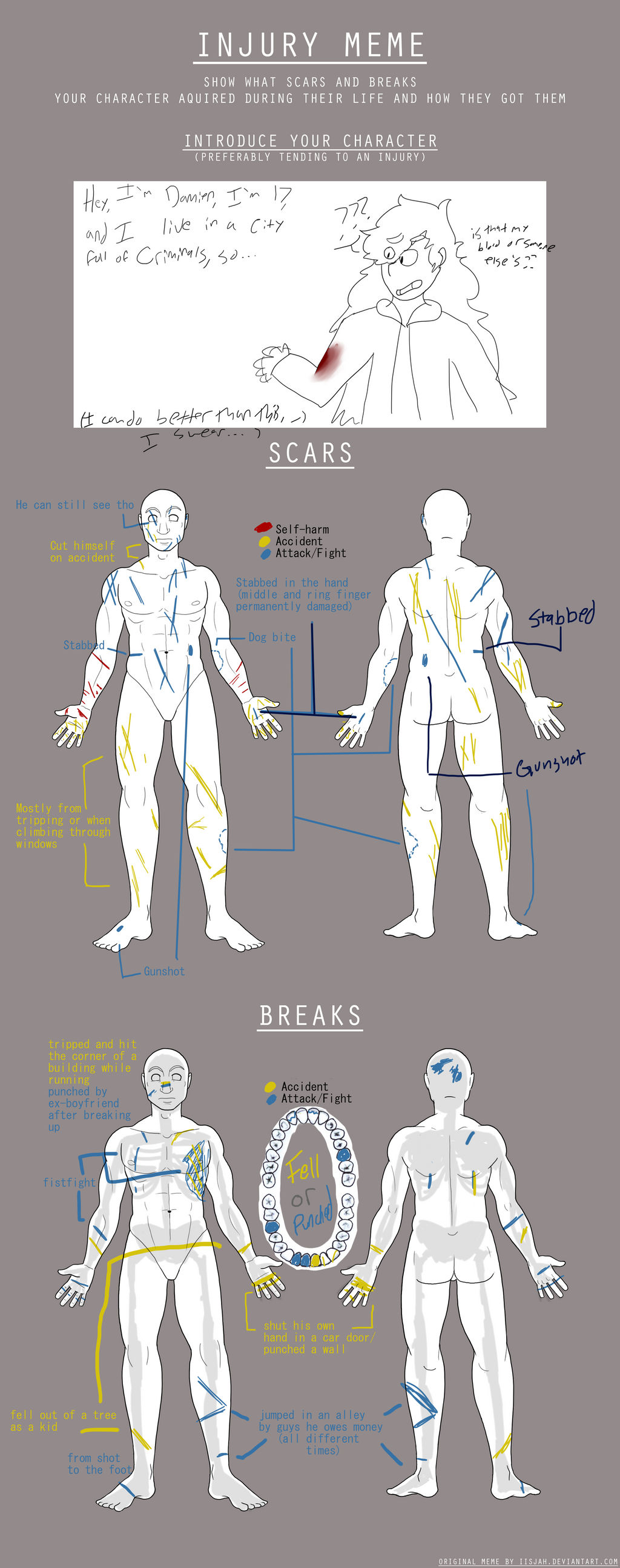 Reportlab Injury Meme Injury Meme by Iumin-ous on DeviantArt