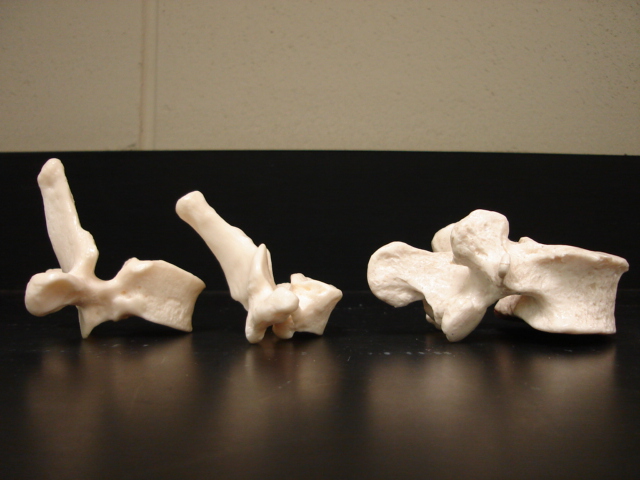 Vertebrae