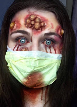 Infected