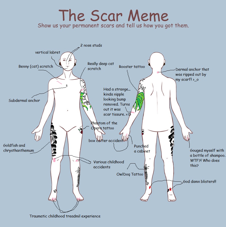 Scar Meme