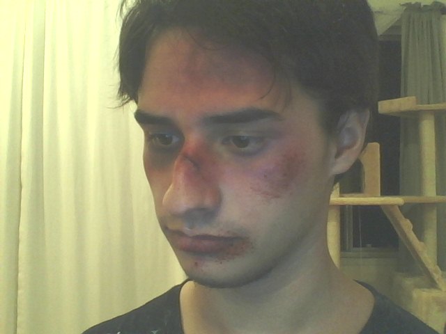 Kunde Skråstreg prototype Bruises and Cut Halloween Makeup 2 by XxRoseAlchemistxX on DeviantArt