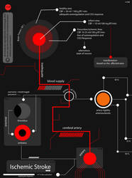 Ischemic Stroke