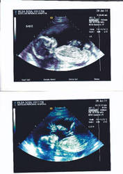 my baby ultrasound