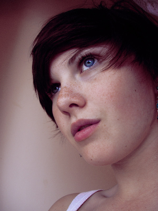 Freckles