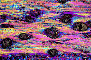Microstructures