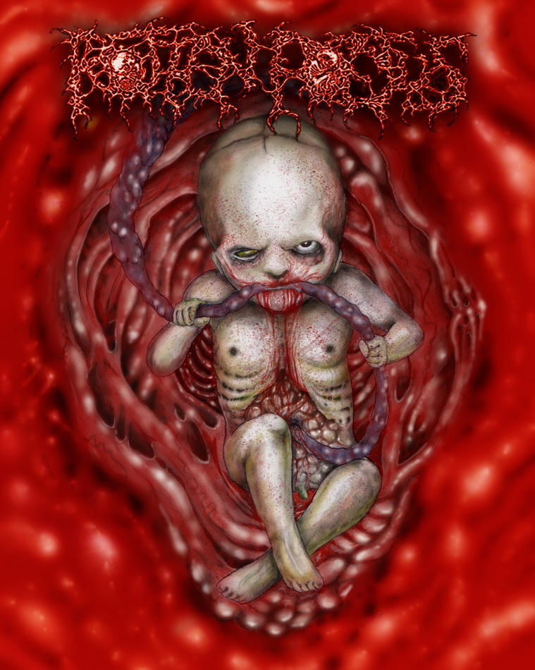 Rotten foetus