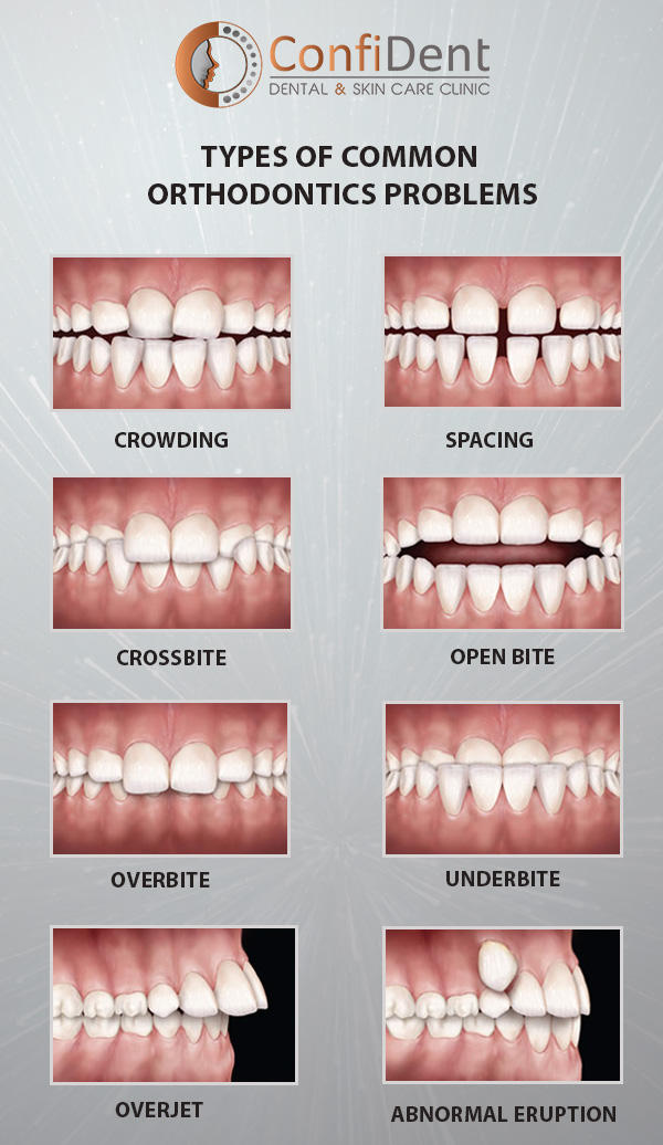 Common Problems – Greenway Orthodontics