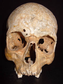 Skull6