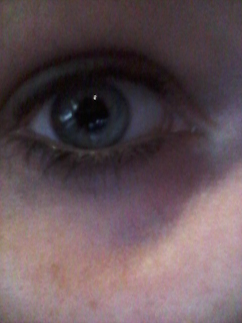 my eye