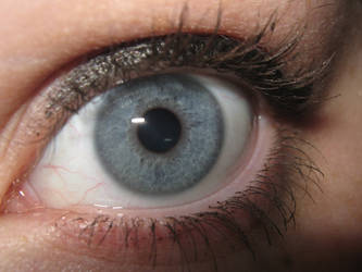 My Eyeball (3)