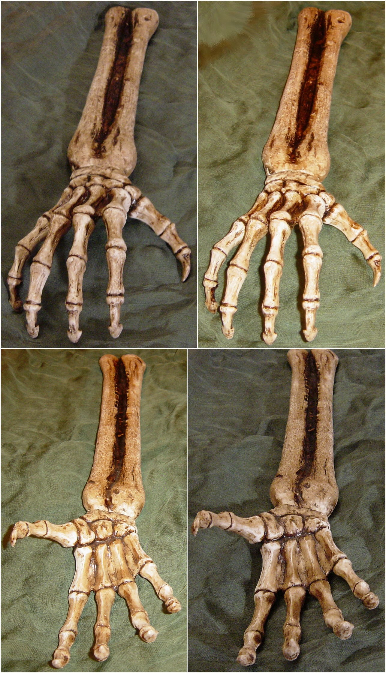 Skeletal Hand Bones + Arm