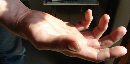 Grey's Relaxed Hand in Light 2
