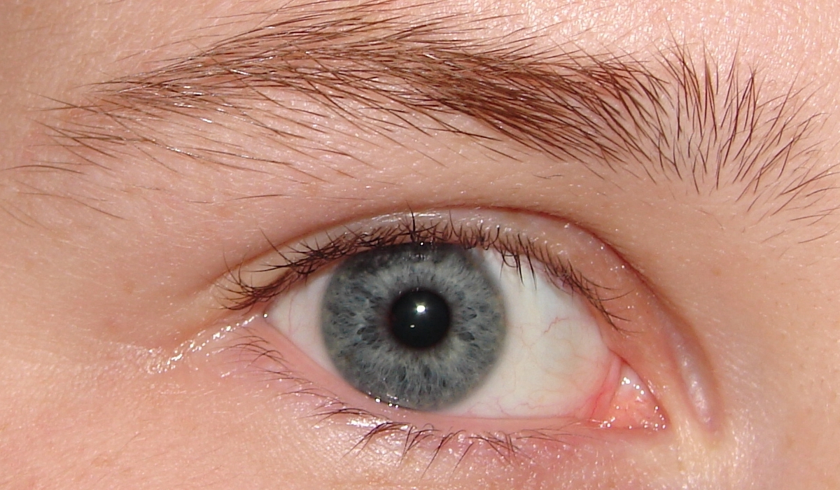 Jodi Anatomy of a Blue Eye 2